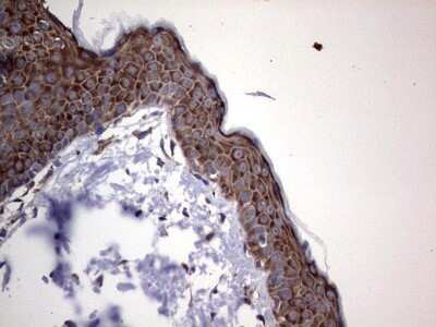 Immunohistochemistry: DOG1/TMEM16A Antibody (OTI1C8) - Azide and BSA Free [NBP2-71987] - Analysis of Human skin tissue. (Heat-induced epitope retrieval by 1 mM EDTA in 10mM Tris, pH8.5, 120C for 3min)