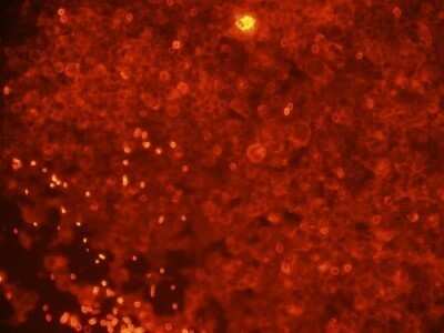 Immunocytochemistry/Immunofluorescence: DOG1/TMEM16A Antibody (SPM580) - Azide and BSA Free [NBP2-34812] - HEK cells expressing Ano1-Myc. SPM580 gave more signal than the Myc Ab control and much more than the SP31 mAb. Negative control cells were negative. ICC image submitted by a verified customer review.