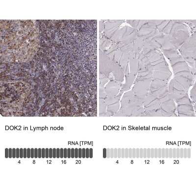 <b>Orthogonal Strategies Validation. </b>Immunohistochemistry-Paraffin: DOK2 Antibody [NBP2-62652] - Analysis in human lymph node and skeletal muscle tissues using Anti-DOK2 antibody. Corresponding DOK2 RNA-seq data are presented for the same tissues.