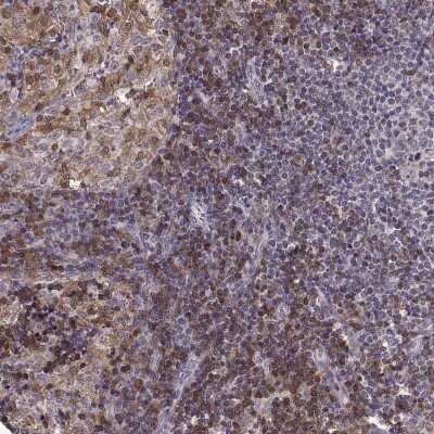 Immunohistochemistry-Paraffin: DOK2 Antibody [NBP2-62652] - Staining of human lymph node shows high expression.