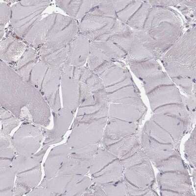 Immunohistochemistry-Paraffin: DOK2 Antibody [NBP2-62652] - Staining of human skeletal muscle shows low expression as expected.