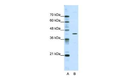 Western Blot: DOK2 Antibody [NBP2-84811] - WB Suggested Anti-DOK2 Antibody Titration: 0.2-1 ug/ml. ELISA Titer: 1:62500. Positive Control: HepG2 cell lysate