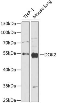 Western Blot: DOK2 Antibody [NBP2-92139] - Analysis of extracts of various cell lines, using DOK2 at 1:1000 dilution.Secondary antibody: HRP Goat Anti-Rabbit IgG (H+L) at 1:10000 dilution.Lysates/proteins: 25ug per lane.Blocking buffer: 3% nonfat dry milk in TBST.Detection: ECL Basic Kit .Exposure time: 30s.