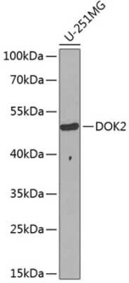 Western Blot: DOK2 Antibody [NBP2-92548] - Analysis of extracts of U-251MG cells, using DOK2 at 1:1000 dilution.Secondary antibody: HRP Goat Anti-Rabbit IgG (H+L) at 1:10000 dilution.Lysates/proteins: 25ug per lane.Blocking buffer: 3% nonfat dry milk in TBST.Detection: ECL Basic Kit .Exposure time: 15s.