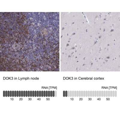 Immunohistochemistry-Paraffin: DOK3 Antibody [NBP2-62717] - Analysis in human lymph node and cerebral cortex tissues using Anti-DOK3 antibody. Corresponding DOK3 RNA-seq data are presented for the same tissues.