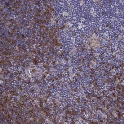 Immunohistochemistry-Paraffin: DOK3 Antibody [NBP2-62717] - Staining of human lymph node shows high expression.