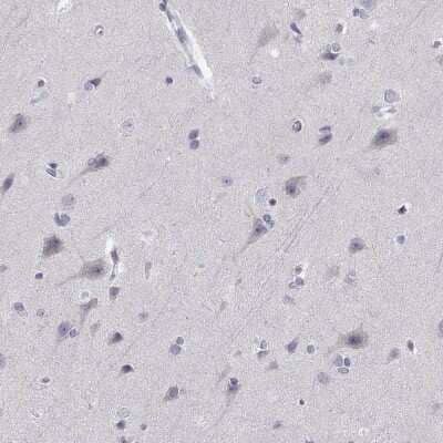 Immunohistochemistry-Paraffin: DOK3 Antibody [NBP2-62717] - Staining of human cerebral cortex shows low expression as expected.
