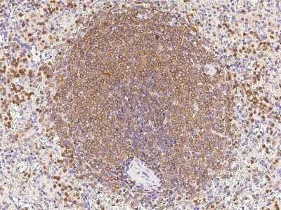 Immunohistochemistry-Paraffin: DOK3 Antibody [NBP2-99574] - Immunochemical staining of human DOK3 in human spleen with rabbit polyclonal antibody at 1:1000 dilution, formalin-fixed paraffin embedded sections.