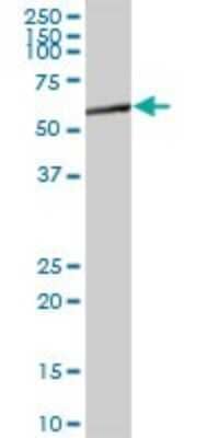 Western Blot: DOK3 Antibody [H00079930-B01P] - Analysis of DOK3 expression in human liver.