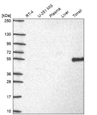 Western Blot: DOK3 Antibody [NBP2-62717] - Analysis in human cell line RT-4, human cell line U-251 MG, human plasma, human liver tissue and human tonsil tissue.
