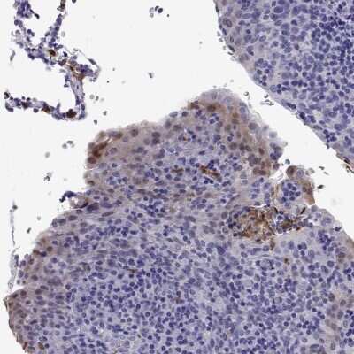 Immunohistochemistry DOK5 Antibody - BSA Free