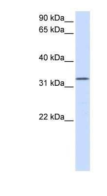 Western Blot: DOK5 Antibody [NBP1-56411] - Human Placenta lysate, concentration 0.2-1 ug/ml.