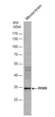 Western Blot: DOK6 Antibody [NBP2-16211] - Mouse tissue extracts (50 ug) was separated by 10 % SDS-PAGE, and the membrane was blotted with DOK6 antibody diluted by 1:1000.