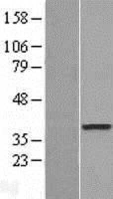 Western Blot: DOK6 Overexpression Lysate (Adult Normal) [NBL1-09981] Left-Empty vector transfected control cell lysate (HEK293 cell lysate); Right -Over-expression Lysate for DOK6.