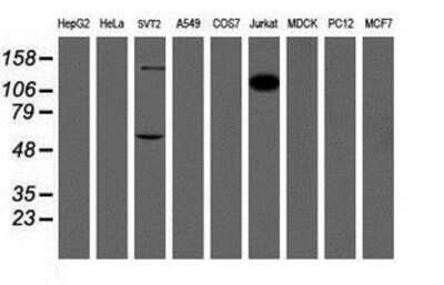 Western Blot: DOK7 Antibody (1A9) [NBP2-02073] Analysis of extracts (35ug) from 9 different cell lines by usin g anti-DOK7 monoclonal antibody (HepG2: human; HeLa: human; SVT2: mouse; A549: human; COS7: monkey; Jurkat: human; MDCK: canine; PC12: rat; MCF7: human).