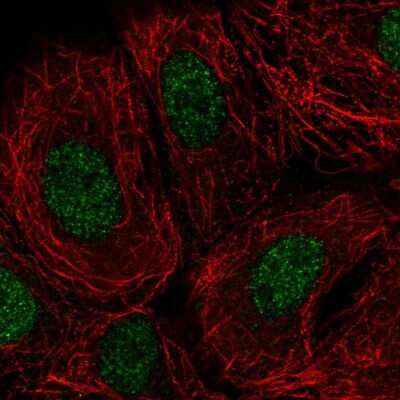 Immunocytochemistry/Immunofluorescence: DOK7 Antibody [NBP2-32465] - Immunofluorescent staining of human cell line MCF7 shows localization to nucleoplasm.