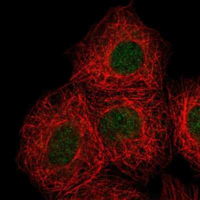 Immunocytochemistry/Immunofluorescence: DOK7 Antibody [NBP2-68794] - Staining of human cell line MCF7 shows localization to nucleus.