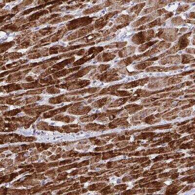 Immunohistochemistry-Paraffin: DOK7 Antibody [NBP2-32465] - Staining of human heart muscle shows strong cytoplasmic positivity in myocytes.