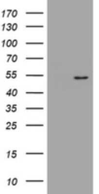 Western Blot: DOK7 Antibody (OTI2C12) - Azide and BSA Free [NBP2-72491] - Analysis of HEK293T cells were transfected with the pCMV6-ENTRY control (Left lane) or pCMV6-ENTRY DOK7.