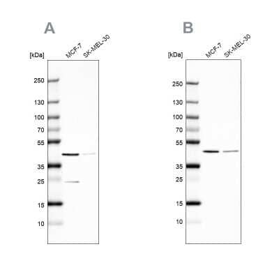 Western Blot: DOK7 Antibody [NBP2-32465] - Analysis NBP2-32465 (A) shows similar pattern to independent antibody NBP2-68794 (B).