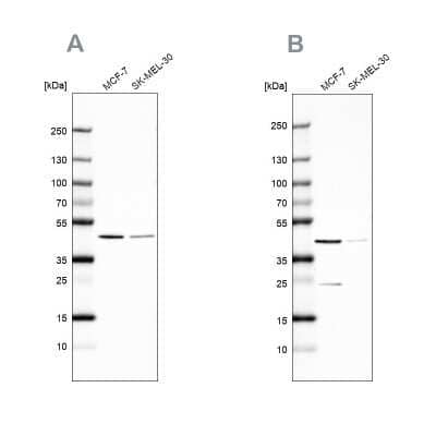 <b>Independent Antibodies Validation. </b>Western Blot: DOK7 Antibody [NBP2-68794] - Analysis NBP2-68794 (A) shows similar pattern to independent antibody NBP2-32465 (B).