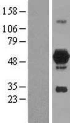 Western Blot DOK7 Overexpression Lysate