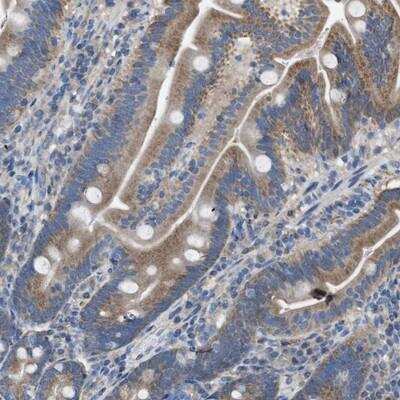 Immunohistochemistry-Paraffin: DOLPP1 Antibody [NBP1-81286] - Staining of human duodenum shows moderate positivity in glandular cells.