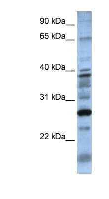 Western Blot DOLPP1 Antibody - BSA Free