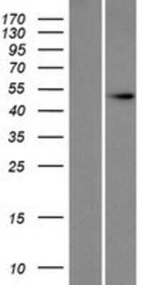 Western Blot: DXO Overexpression Lysate (Native) [NBP2-07740] - Left-Empty vector transfected control cell lysate (HEK293 cell lysate); Right -Over-expression Lysate for DOM3Z.