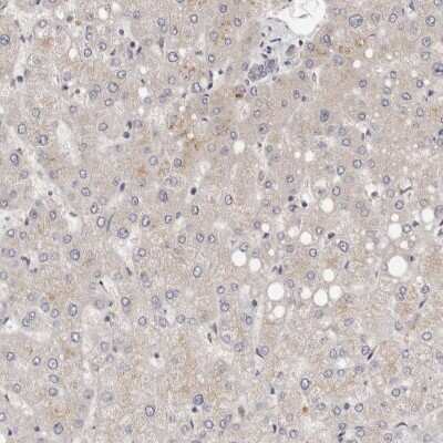 Immunohistochemistry-Paraffin: DOPEY1 Antibody [NBP1-90581] - Staining of human liver shows low expression as expected.