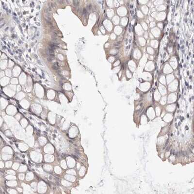 Immunohistochemistry-Paraffin: DOPEY1 Antibody [NBP1-90582] - Staining of human rectum shows  weak cytoplasmic positivity in glandular cells.