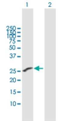 Western Blot: DORA Antibody [H00010261-B01P] - Analysis of IGSF6 expression in transfected 293T cell line by IGSF6 polyclonal antibody.  Lane 1: IGSF6 transfected lysate(26.51 KDa). Lane 2: Non-transfected lysate.