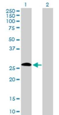 Western Blot: DORA Antibody [H00010261-D01P] - Analysis of IGSF6 expression in transfected 293T cell line by IGSF6 polyclonal antibody.Lane 1: IGSF6 transfected lysate(27.00 KDa).Lane 2: Non-transfected lysate.