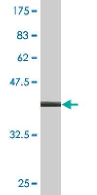 Western Blot: DOT1L Antibody (8B2) [H00084444-M02] -  detection against Immunogen (37.4 KDa) .