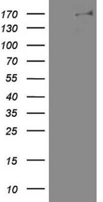 Western Blot: DOT1L Antibody (OTI1D8) - Azide and BSA Free [NBP2-72297] - Analysis of HEK293T cells were transfected with the pCMV6-ENTRY control (Left lane) or pCMV6-ENTRY DOT1L.