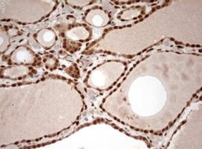 Immunohistochemistry: DOT1L Antibody (OTI6E7) - Azide and BSA Free [NBP2-72298] - Analysis of Human thyroid tissue. (Heat-induced epitope retrieval by 10mM citric buffer, pH6.0, 120C for 3min)