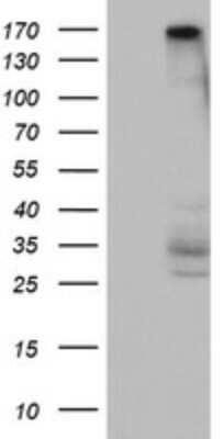 Western Blot: DOT1L Antibody (OTI6E7) - Azide and BSA Free [NBP2-72298] - Analysis of HEK293T cells were transfected with the pCMV6-ENTRY control (Left lane) or pCMV6-ENTRY DOT1L.