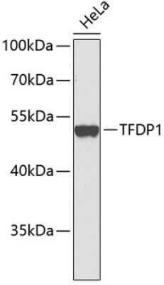 Western Blot: DP1 Antibody [NBP3-03877] - Analysis of extracts of HeLa cells, using DP1 antibody . Secondary antibody: HRP Goat Anti-Rabbit IgG (H+L) at 1:10000 dilution. Lysates/proteins: 25ug per lane. Blocking buffer: 3% nonfat dry milk in TBST.