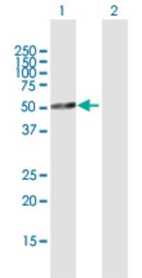 Western Blot: DP2 Antibody [H00007029-D01P] - Analysis of TFDP2 expression in transfected 293T cell line by TFDP2 polyclonal antibody.Lane 1: TFDP2 transfected lysate(43.00 KDa).Lane 2: Non-transfected lysate.
