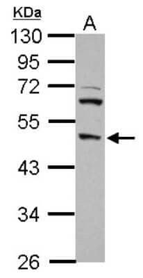 Western Blot: DP2 Antibody [NBP2-16216] - Sample (30 ug of whole cell lysate) A: PC-3 10% SDS PAGE gel, diluted at 1:1000.
