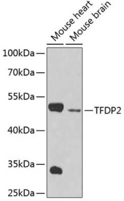 Western Blot: DP2 Antibody [NBP2-92440] - Analysis of extracts of various cell lines, using DP2 at 1:1000 dilution. Secondary antibody: HRP Goat Anti-Rabbit IgG (H+L) at 1:10000 dilution. Lysates/proteins: 25ug per lane. Blocking buffer: 3% nonfat dry milk in TBST. Detection: ECL Basic Kit . Exposure time: 60s.