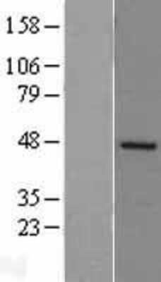 Western Blot: DP2 Overexpression Lysate (Adult Normal) [NBL1-16836] Left-Empty vector transfected control cell lysate (HEK293 cell lysate); Right -Over-expression Lysate for DP2.