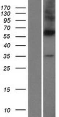 Western Blot: DPAGT1 Overexpression Lysate (Adult Normal) [NBL1-09985] Left-Empty vector transfected control cell lysate (HEK293 cell lysate); Right -Over-expression Lysate for DPAGT1.