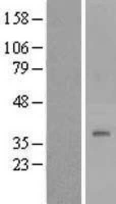 Western Blot: DPAGT1 Overexpression Lysate (Adult Normal) [NBP2-08215] Left-Empty vector transfected control cell lysate (HEK293 cell lysate); Right -Over-expression Lysate for DPAGT1.