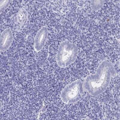 Immunohistochemistry-Paraffin DPEP3 Antibody - BSA Free