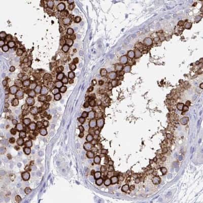 Immunohistochemistry-Paraffin DPEP3 Antibody - BSA Free