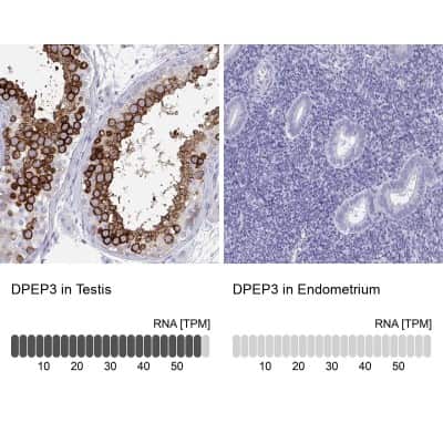 Immunohistochemistry-Paraffin DPEP3 Antibody - BSA Free