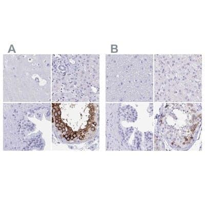 Immunohistochemistry-Paraffin: DPEP3 Antibody [NBP2-32395] - Staining of human cerebral cortex, liver, prostate and testis using Anti-DPEP3 antibody NBP2-32395 (A) shows similar protein distribution across tissues to independent antibody NBP2-34182 (B).