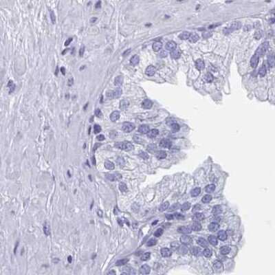 Immunohistochemistry-Paraffin: DPEP3 Antibody [NBP2-32395] - Staining of human prostate.