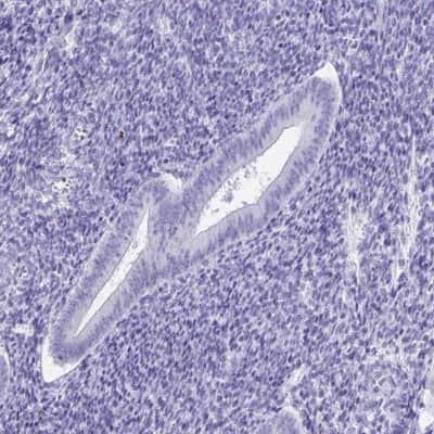 Immunohistochemistry-Paraffin DPEP3 Antibody - BSA Free